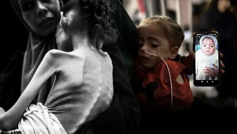 Küçük Meryem'in Açlıkla Mücadelesi: 25 Kilodan 10 Kiloya Düştü