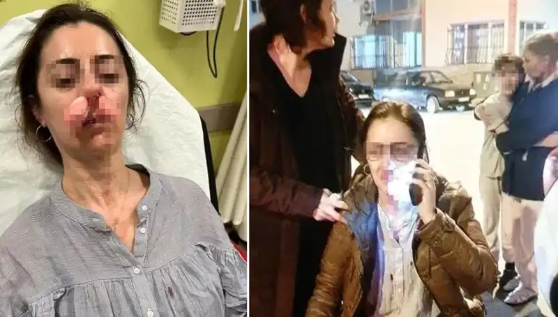 Otomobil Kapısı Silah Sayıldı: Eşinin Sevgilisi Sandığı Kişiye Saldırdı!