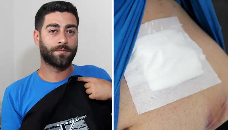 Karnında Şiddetli Ağrı Çeken Hasta, Röntgen Sonuçlarıyla Şaşkına Döndü