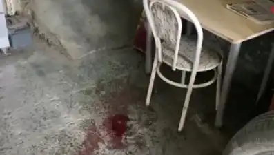 Sandalyeden Düşen Adamın Hayatı Tehlikede: Korkunç Kaza Anı